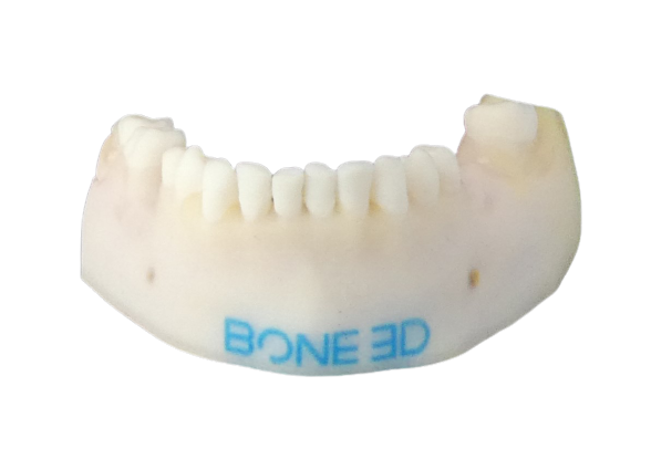 Simulateur chirurgie orale imprimé en 3D