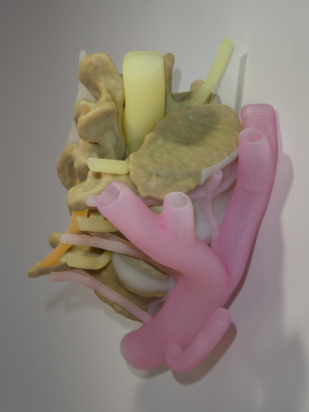 Modèle anatomique rachis imprimé en 3D - coté