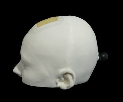 Simulateur imprimé en 3D pour la formation des neurochirurgiens vue coté gauche