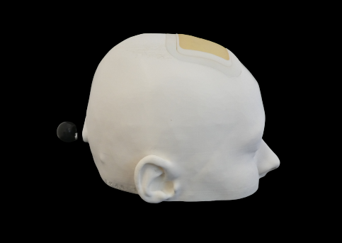 Simulateur imprimé en 3D pour la formation des neurochirurgiens vue coté droit