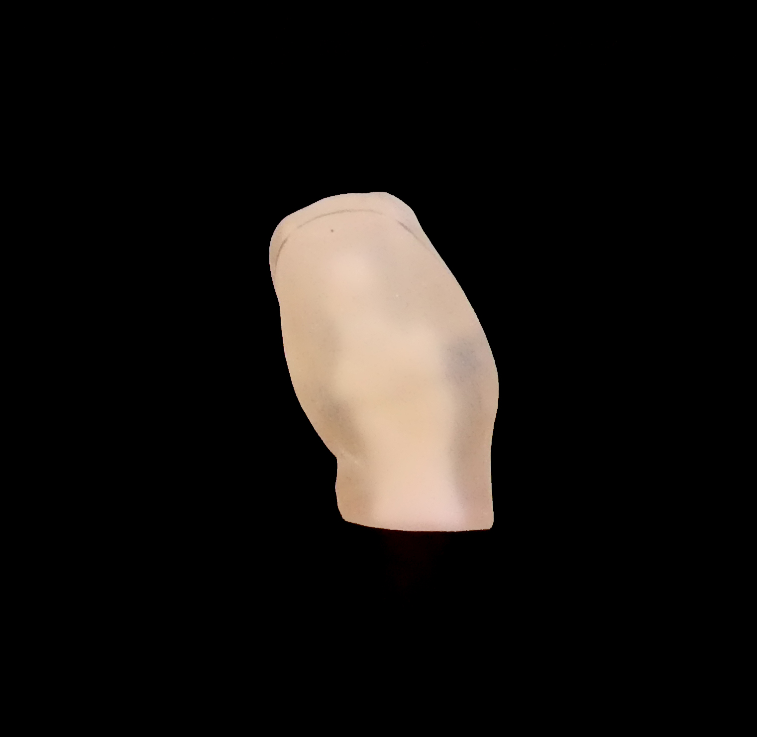 Simulateur de chirurgie imprimé en 3D PODO-Train vu de dos - hallux