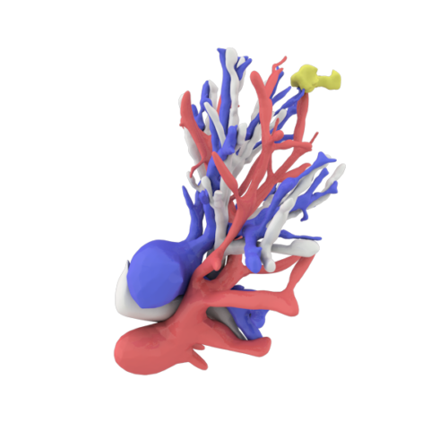 Modèle anatomique de bronches imprimé en 3D