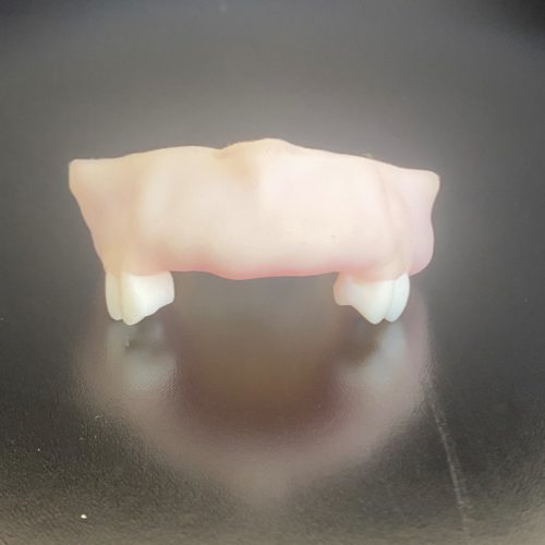 Modèle d'implantologie à 6 sites (position anatomique) imprimé en 3D