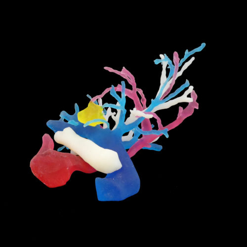 Modèle anatomique de bronches avec tumeur imprimé en 3D 