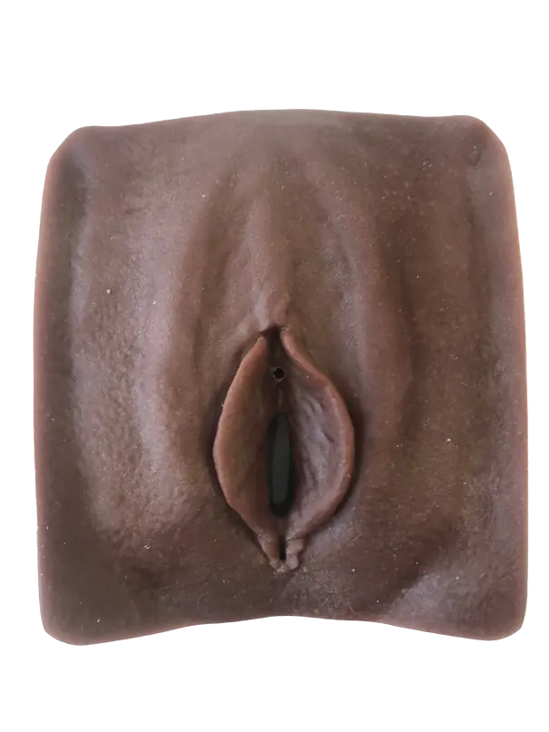 Modèle anatomique · excision de type 1