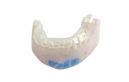 Mandibule opérable