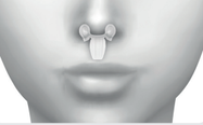 Visualisation 3D de RHINO sur patient, vue de face